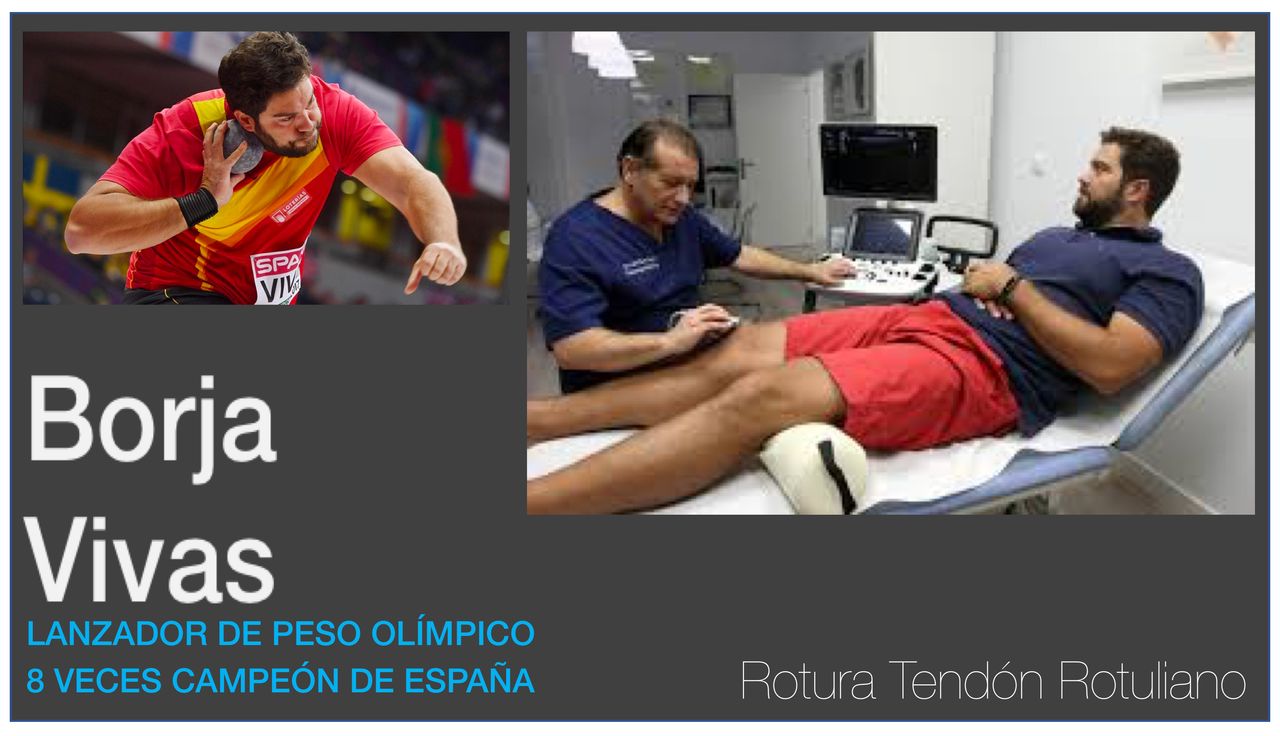 Vicente De La Varga Salto-13