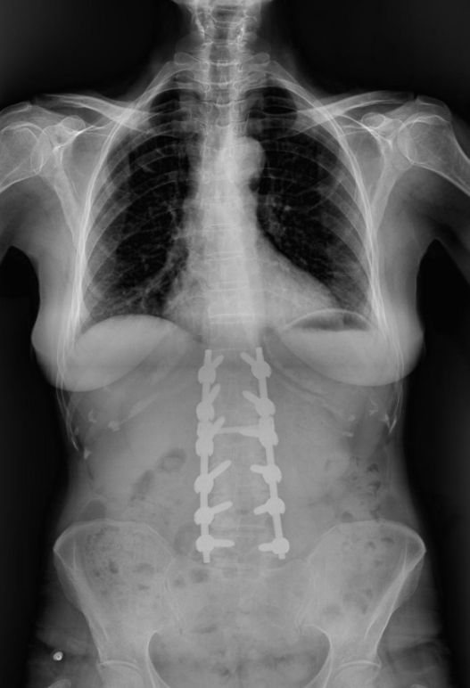 Nizamettin Güzel-11