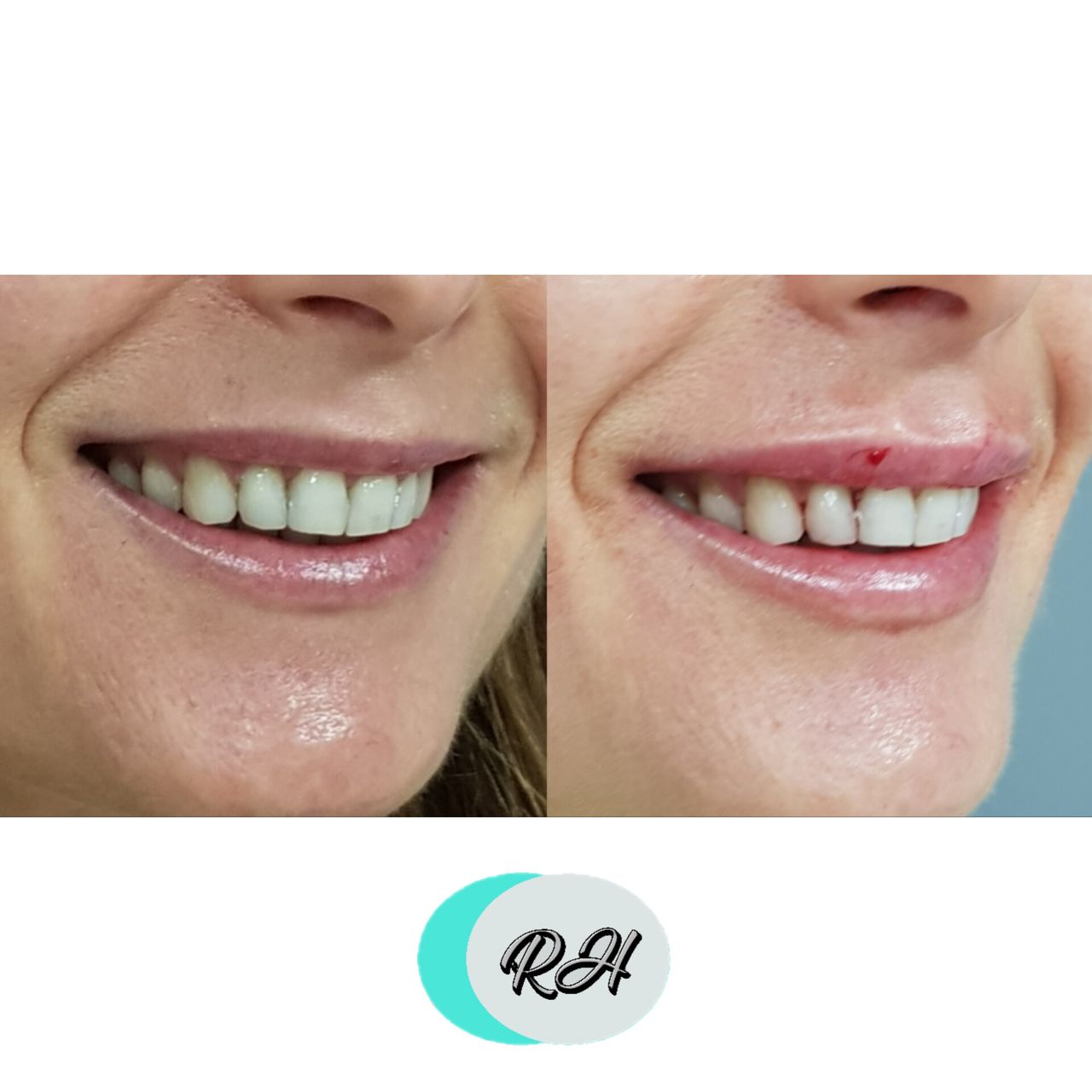 Rosalba Herrero Zerpa-136