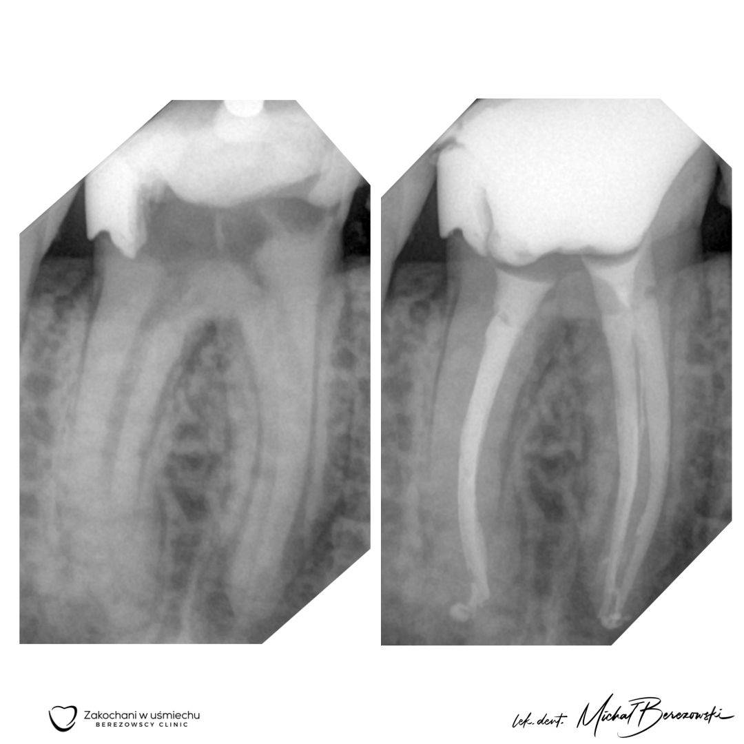 Michał Berezowski-18