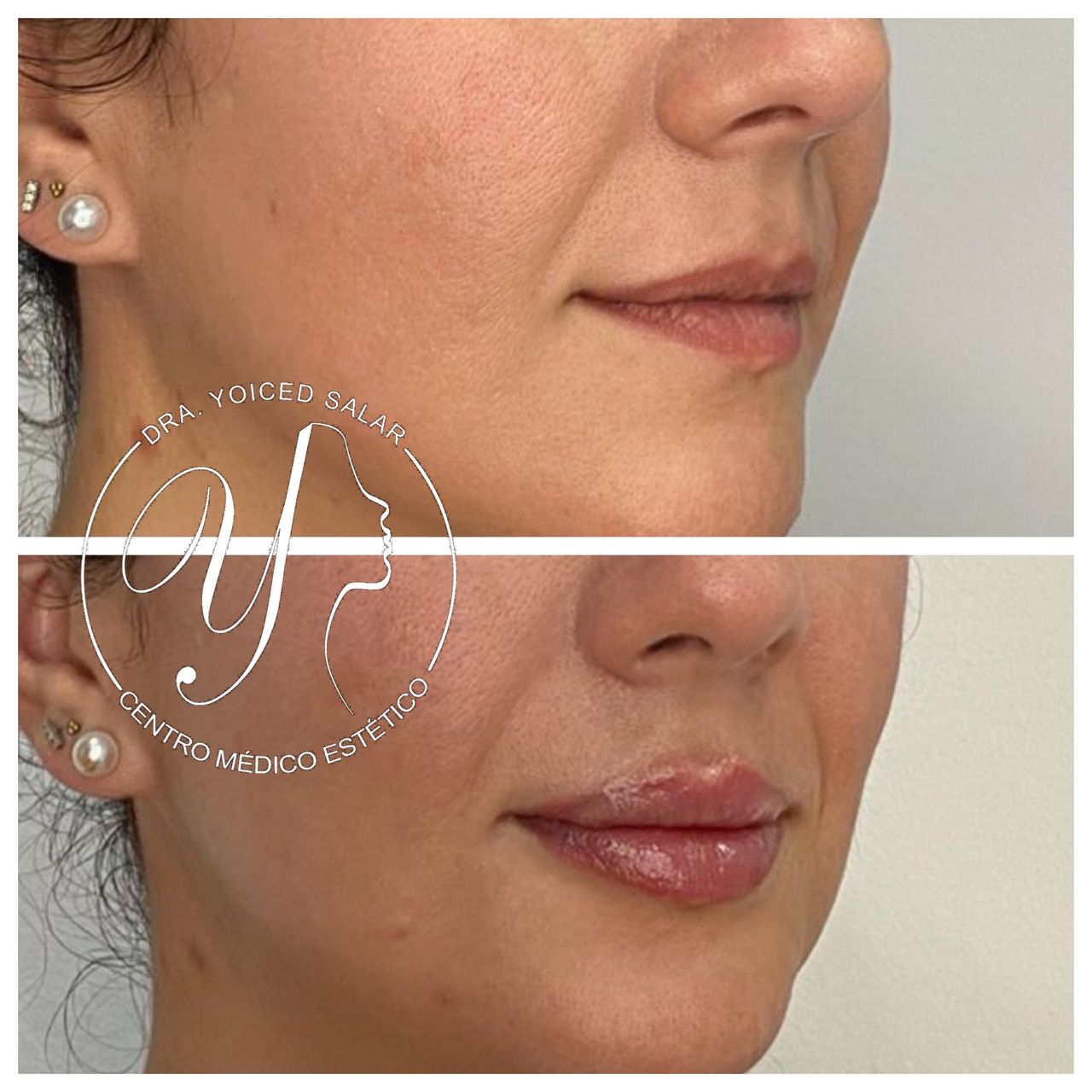 Yoiced Salar Peñate-16