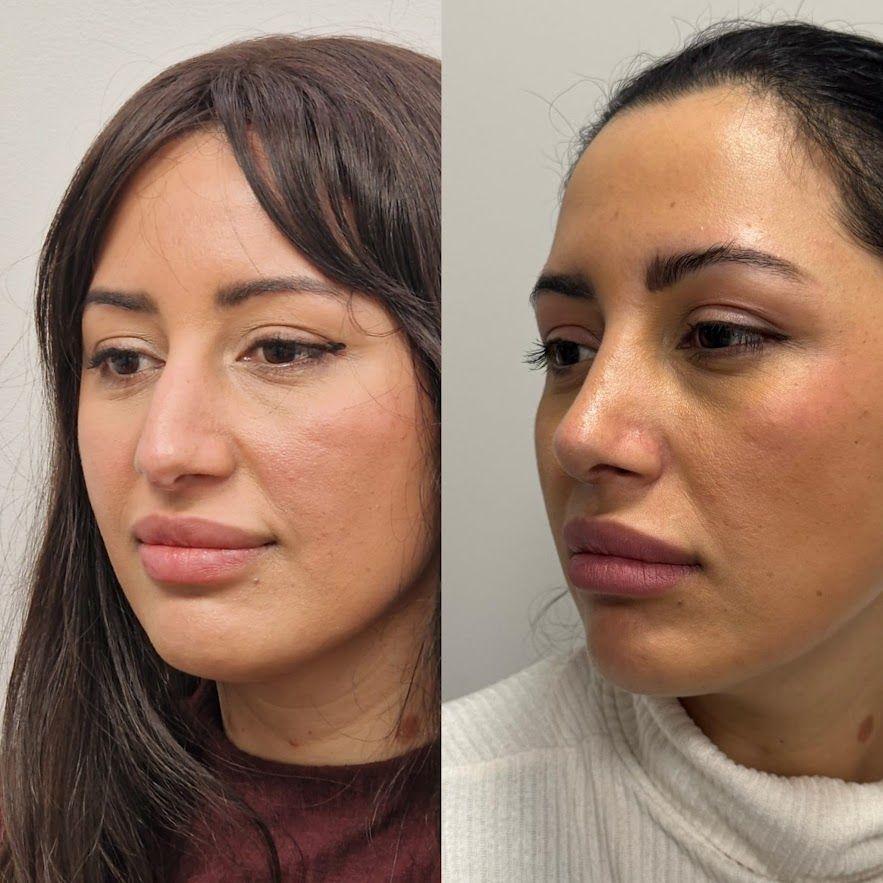 Sandra Marleny Casasola Girón-1