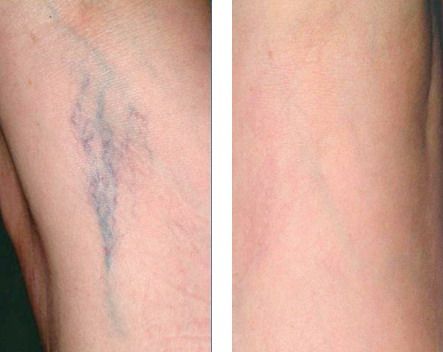 Edoardo Leonardo Rubattu-43