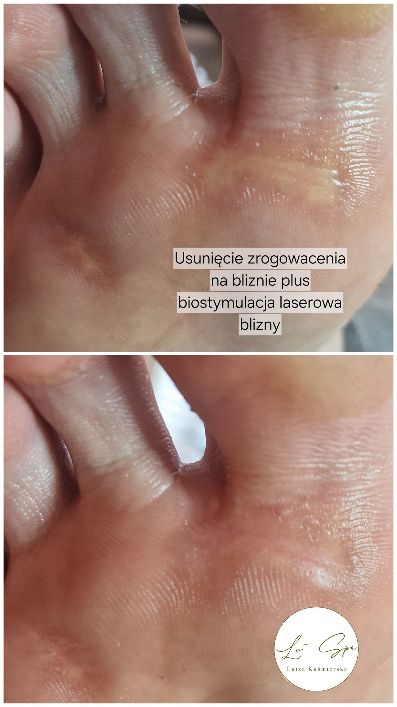 Luiza Kuśmierska-10