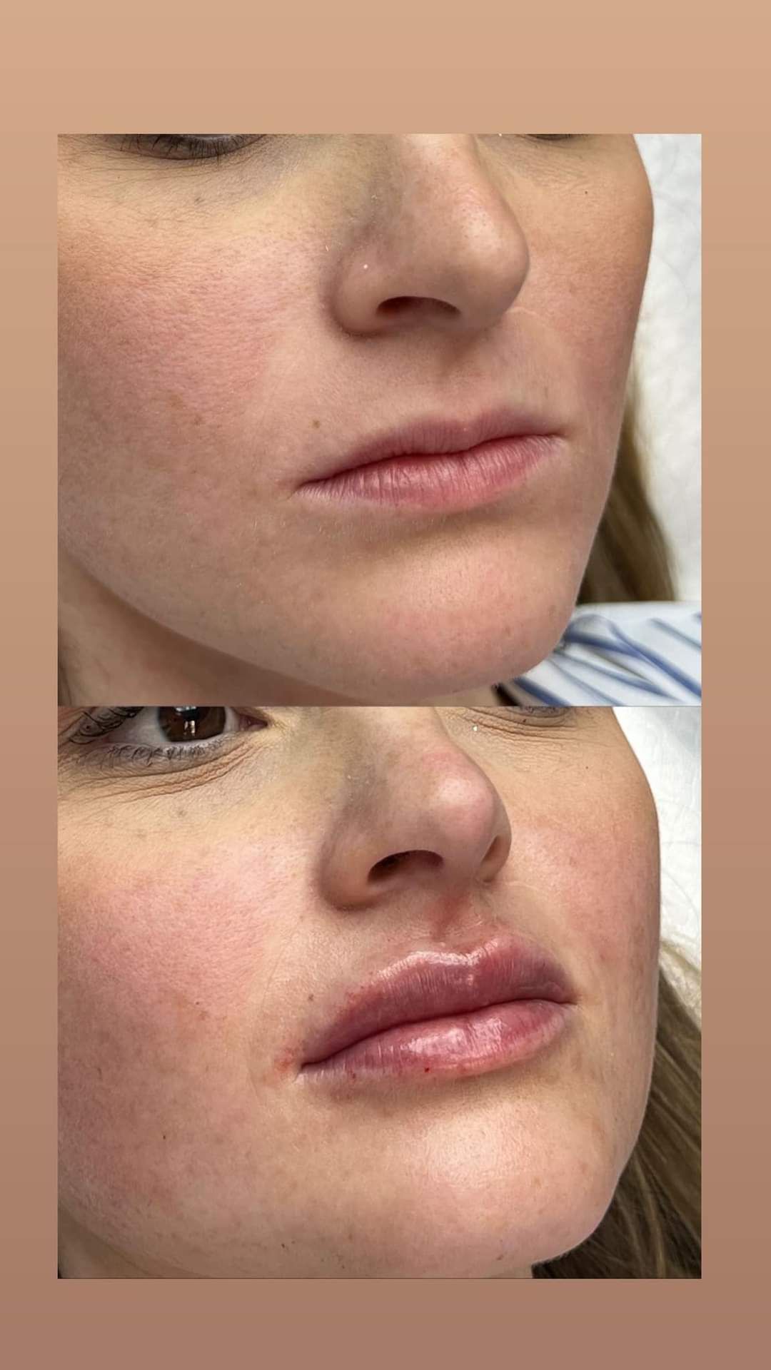 Vincenzo Santillo-10