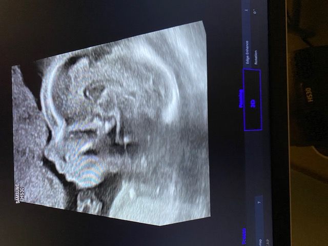 Roberto Procaccianti-4