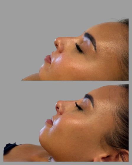 Javier Lima Villamil-3