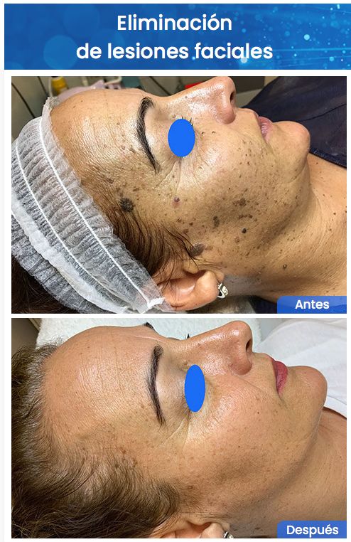 Juan Enrique Pérez Enríquez-140