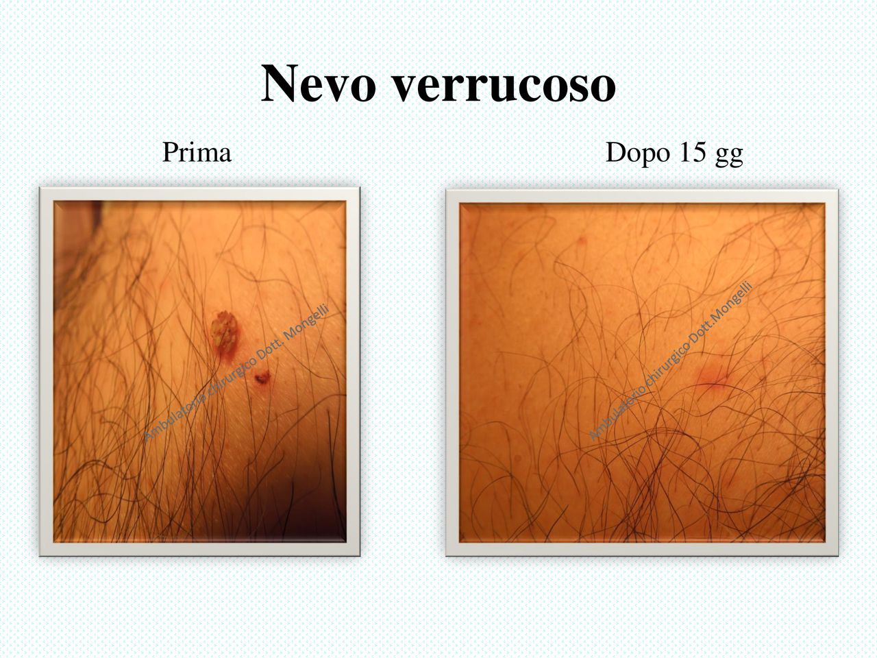 Matteo Antonio Mongelli-9