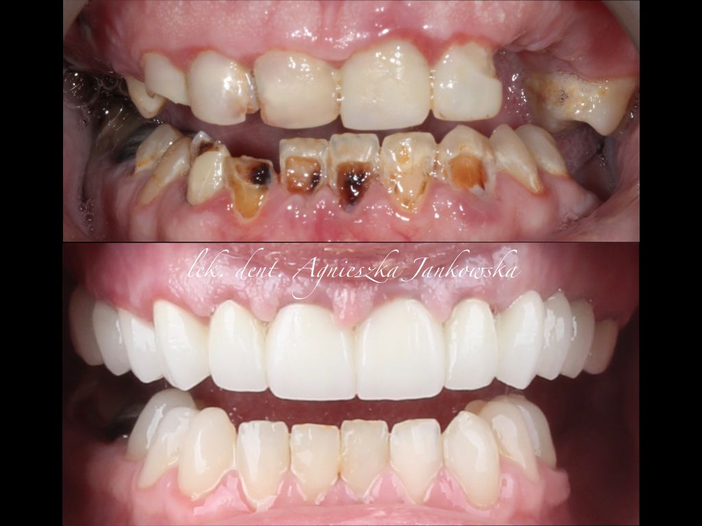 Agnieszka Jankowska-Smolińska-4