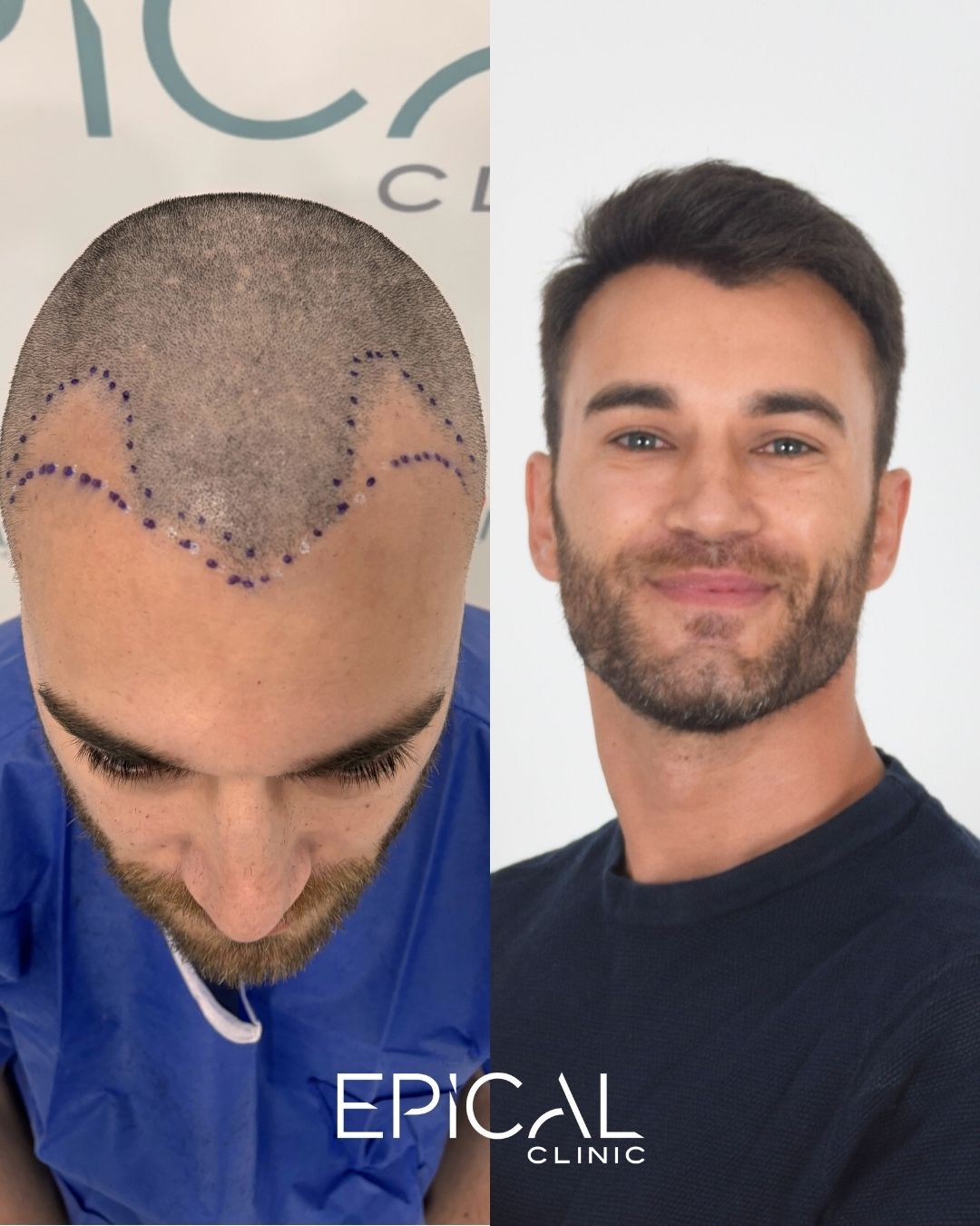 Juan Francisco Belén Montero-27