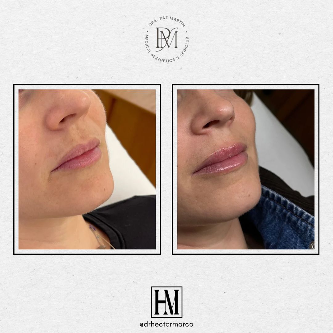 Héctor Marco Ruiz-12