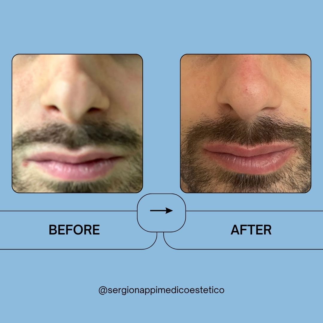 Sergio Nappi-2