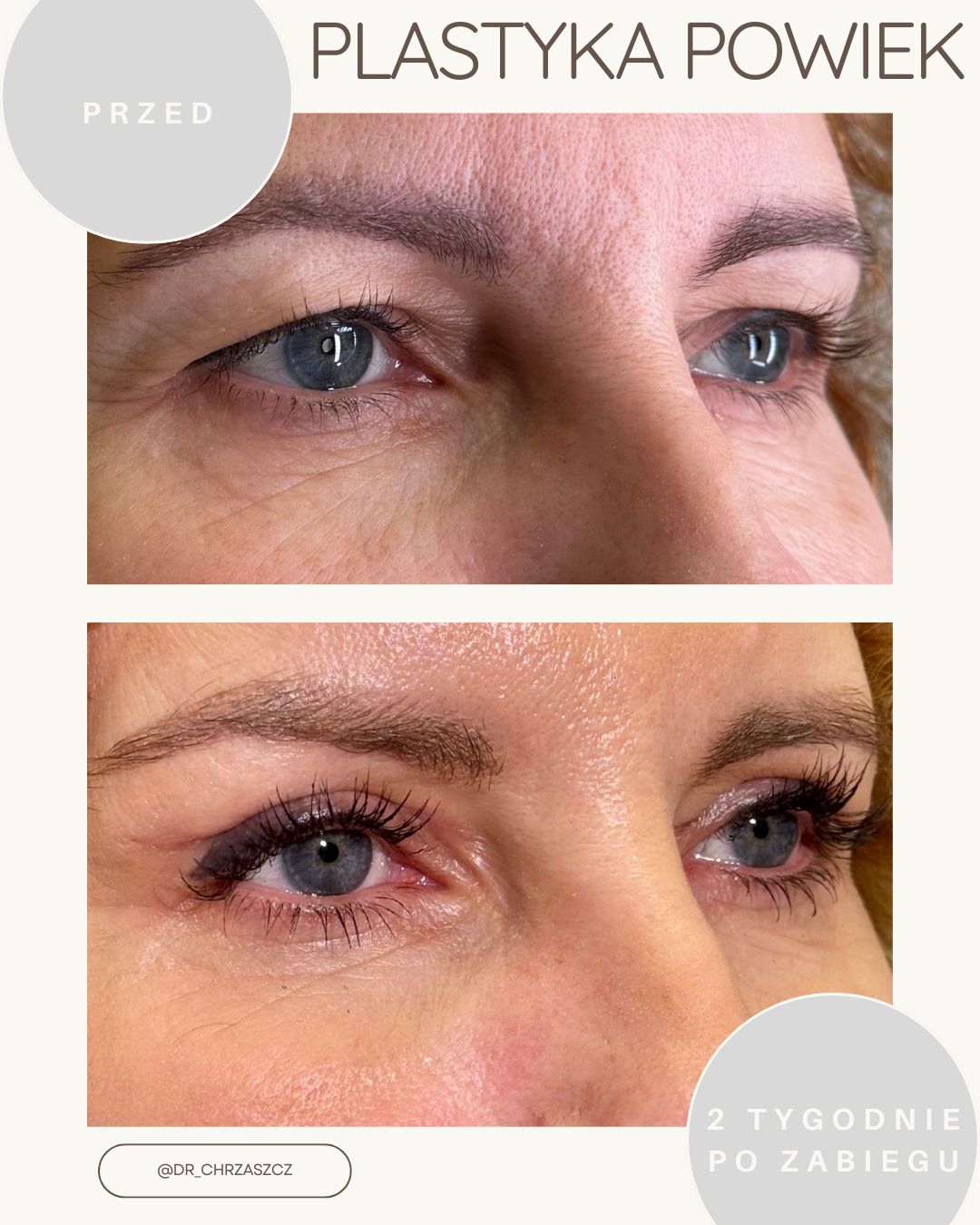 Michał Chrząszcz-8