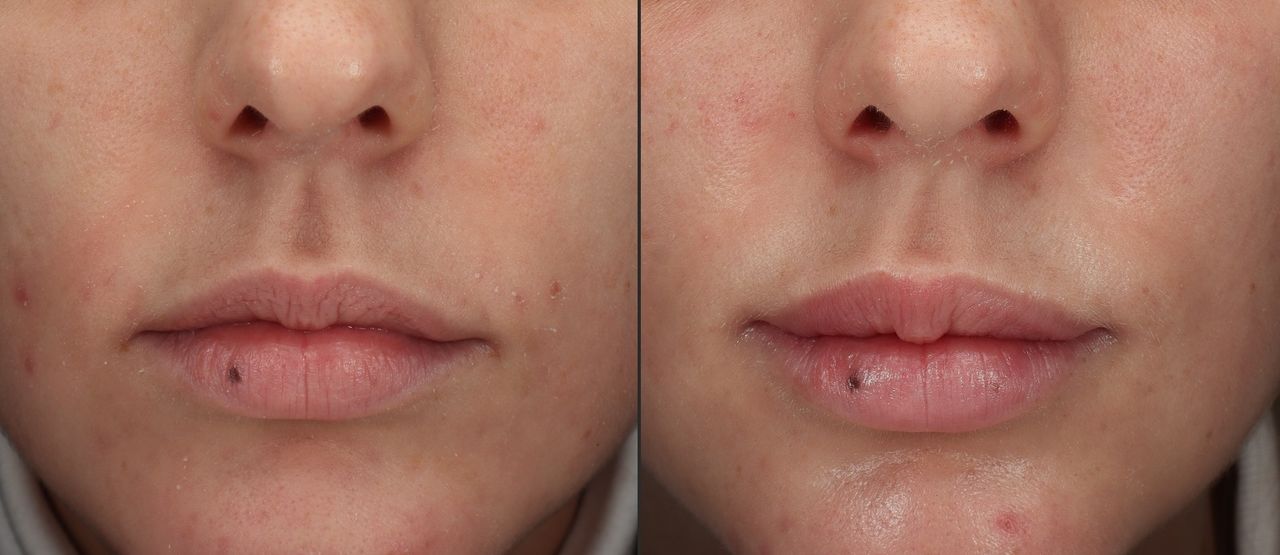 Giordano Vespasiani-30