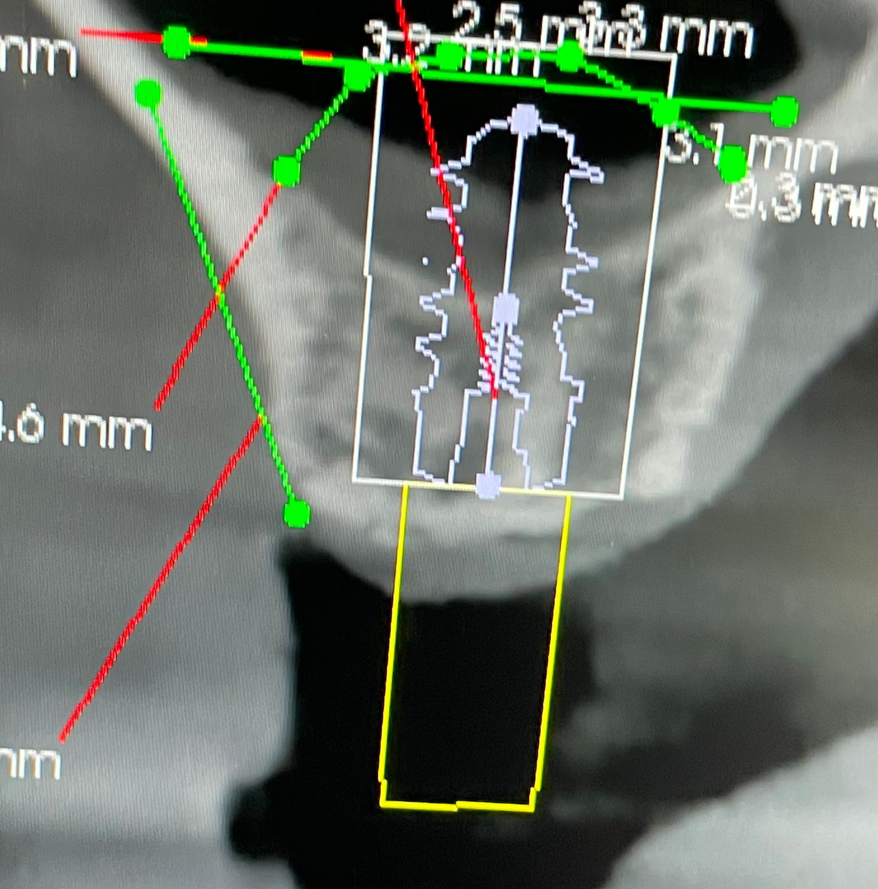 Cezary Pogorzelski-26