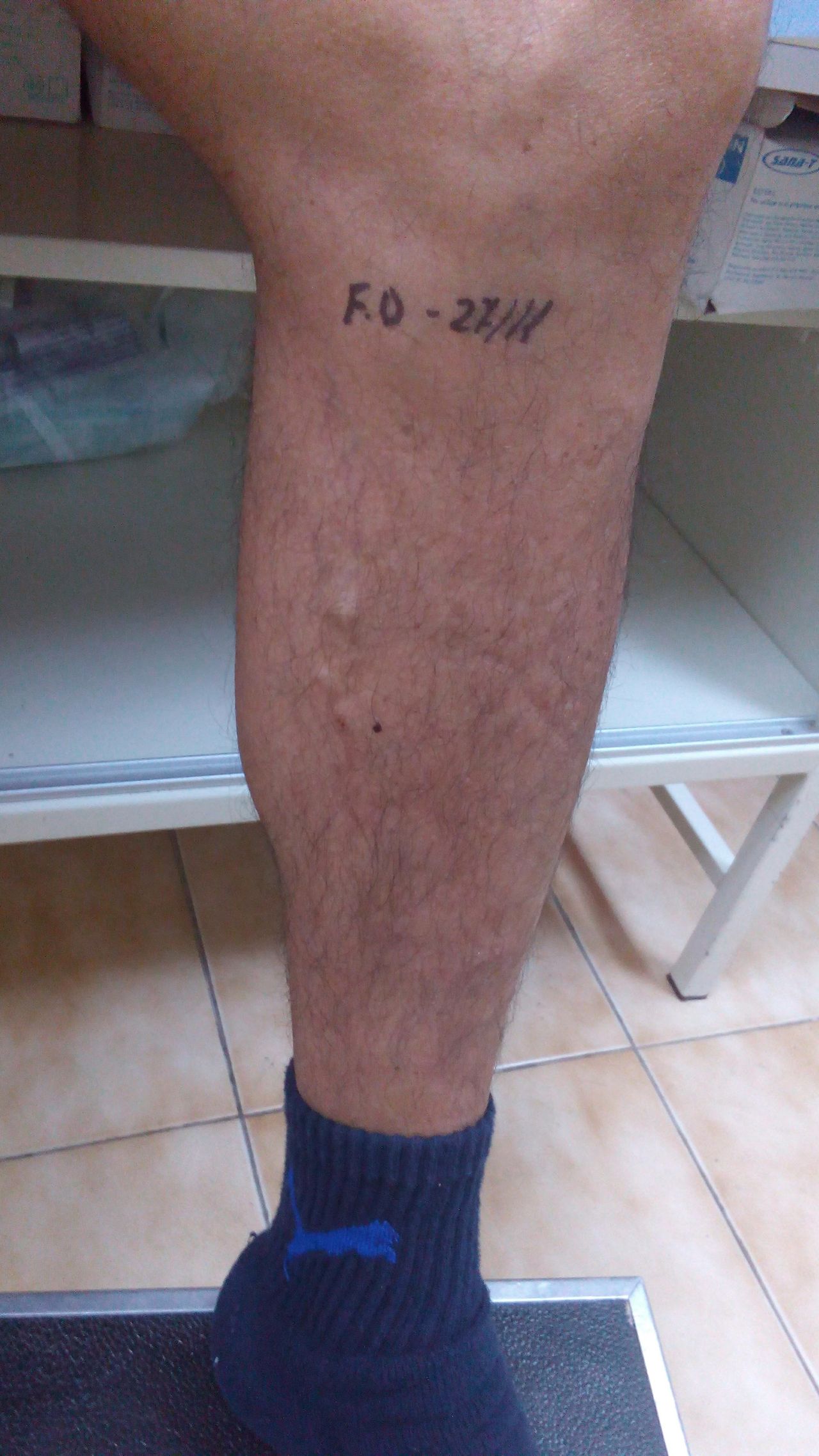 Arnaldo Strazzaboschi-7