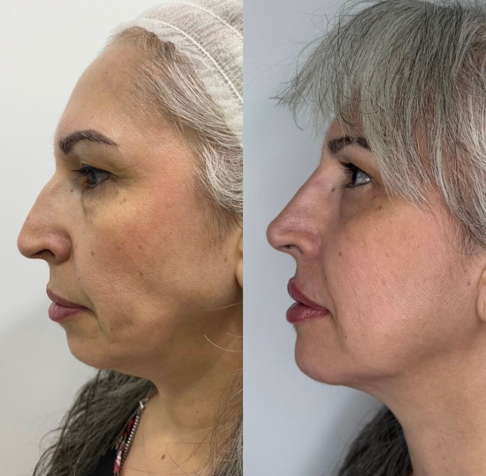 Raffaele Del Prete-7