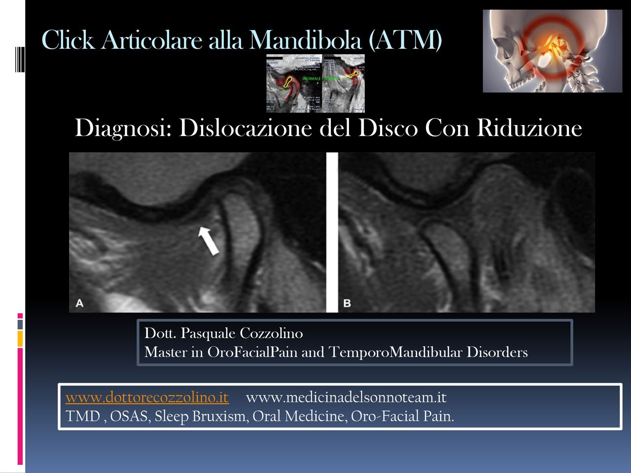 Pasquale Cozzolino-3