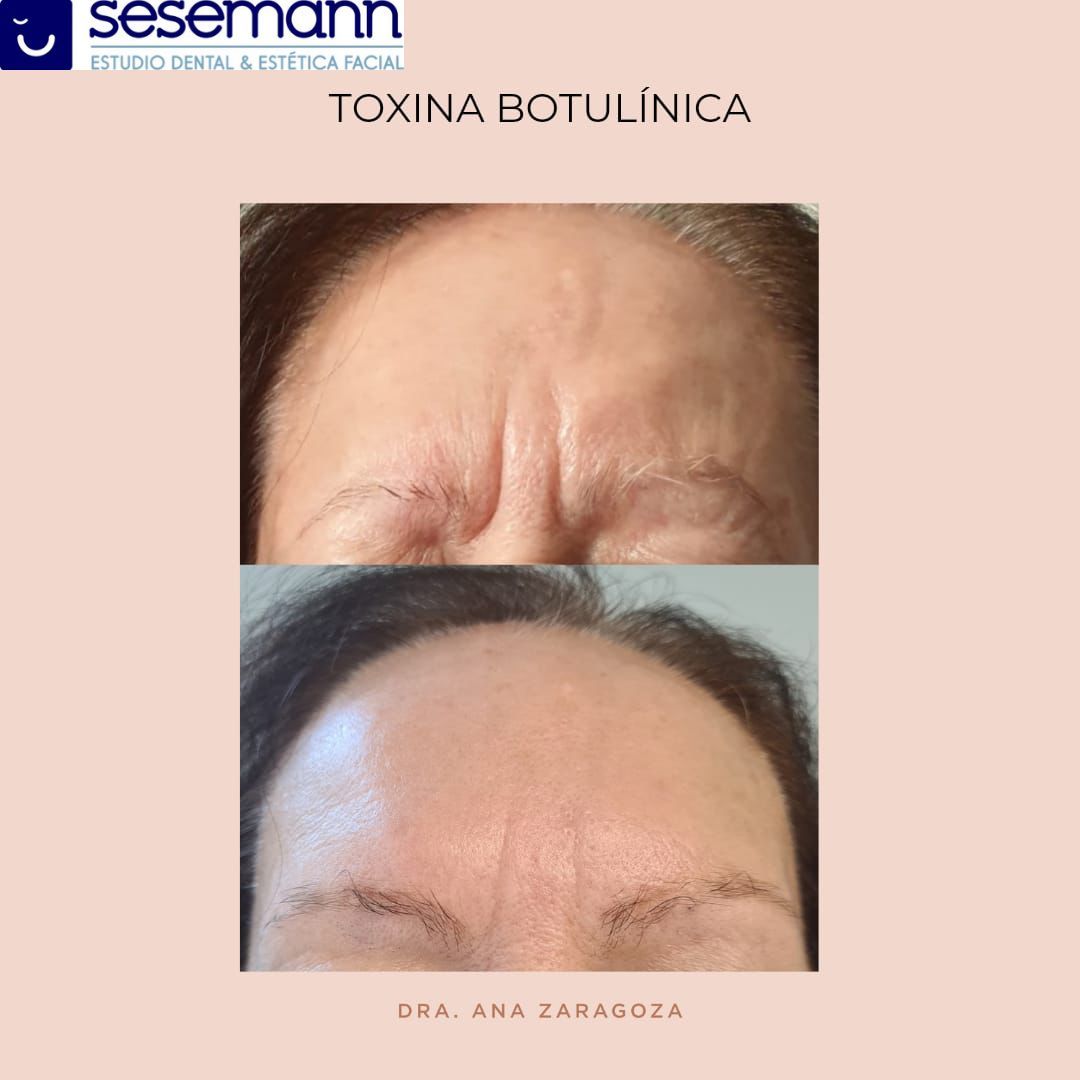 Paula Cano Carrillo-67