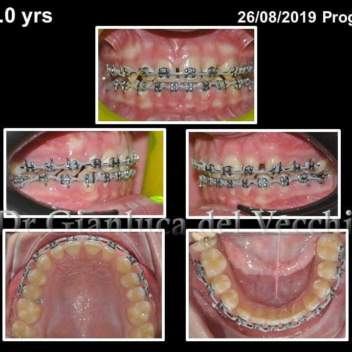 Gianluca Del Vecchio-50