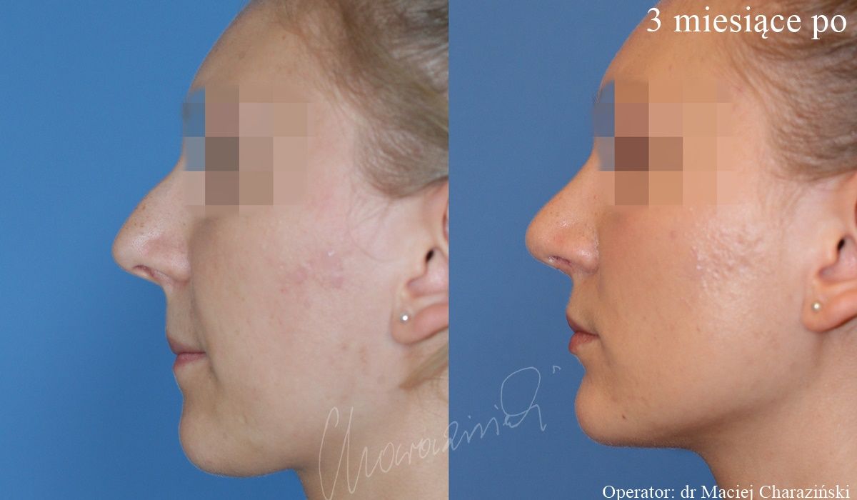 Maciej Charaziński-52