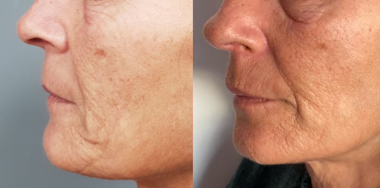 Rosalba Herrero Zerpa-50