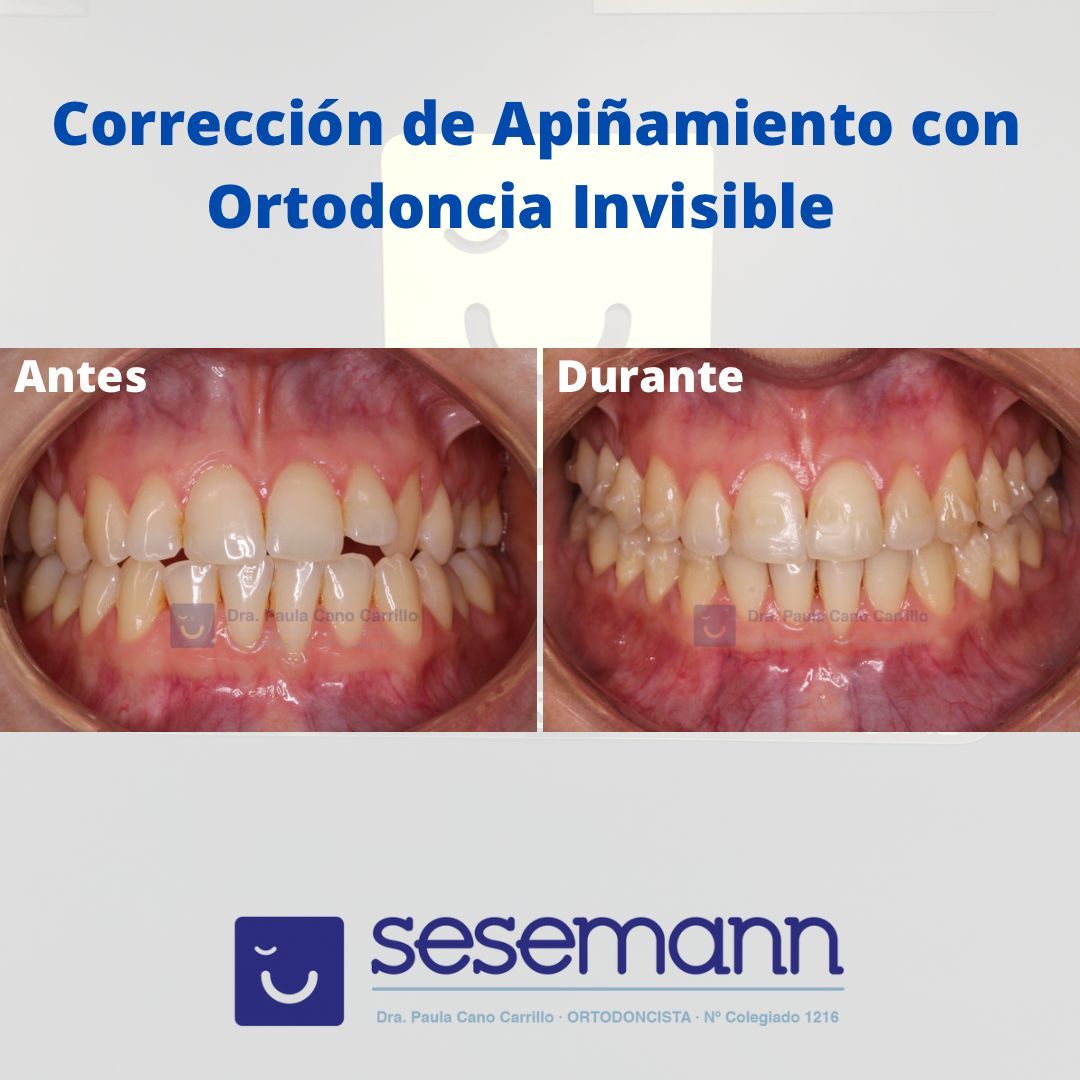 Paula Cano Carrillo-38