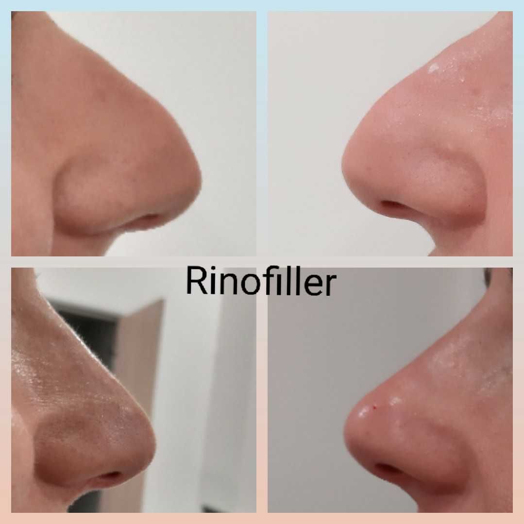 Paola Della Rocca-24