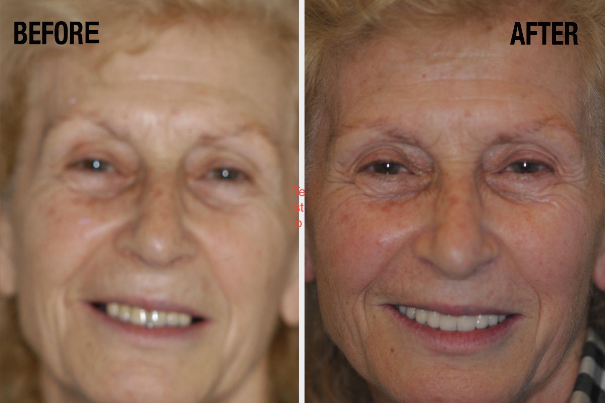 Alessandro Palumbo-40