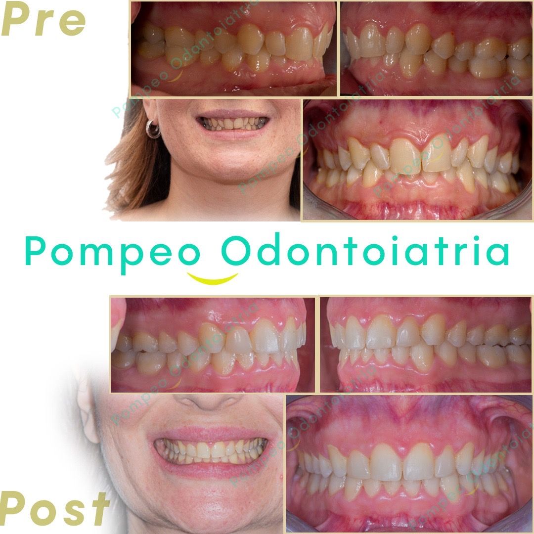 Enrico Maria Pompeo-0