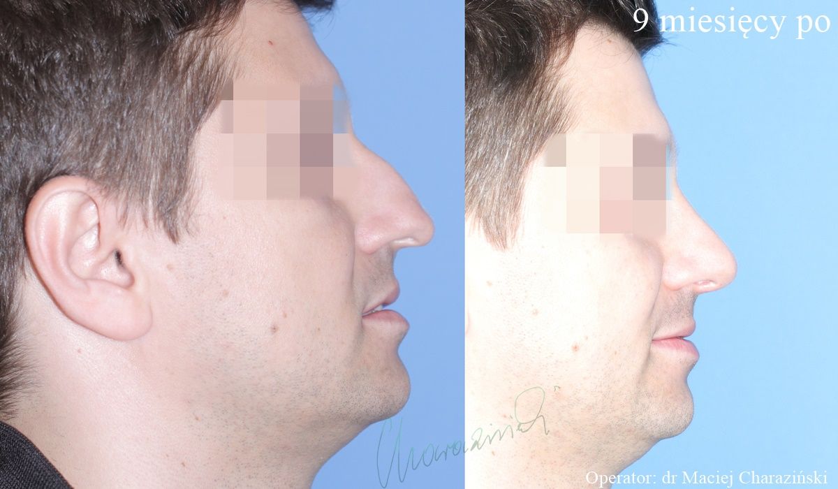 Maciej Charaziński-43