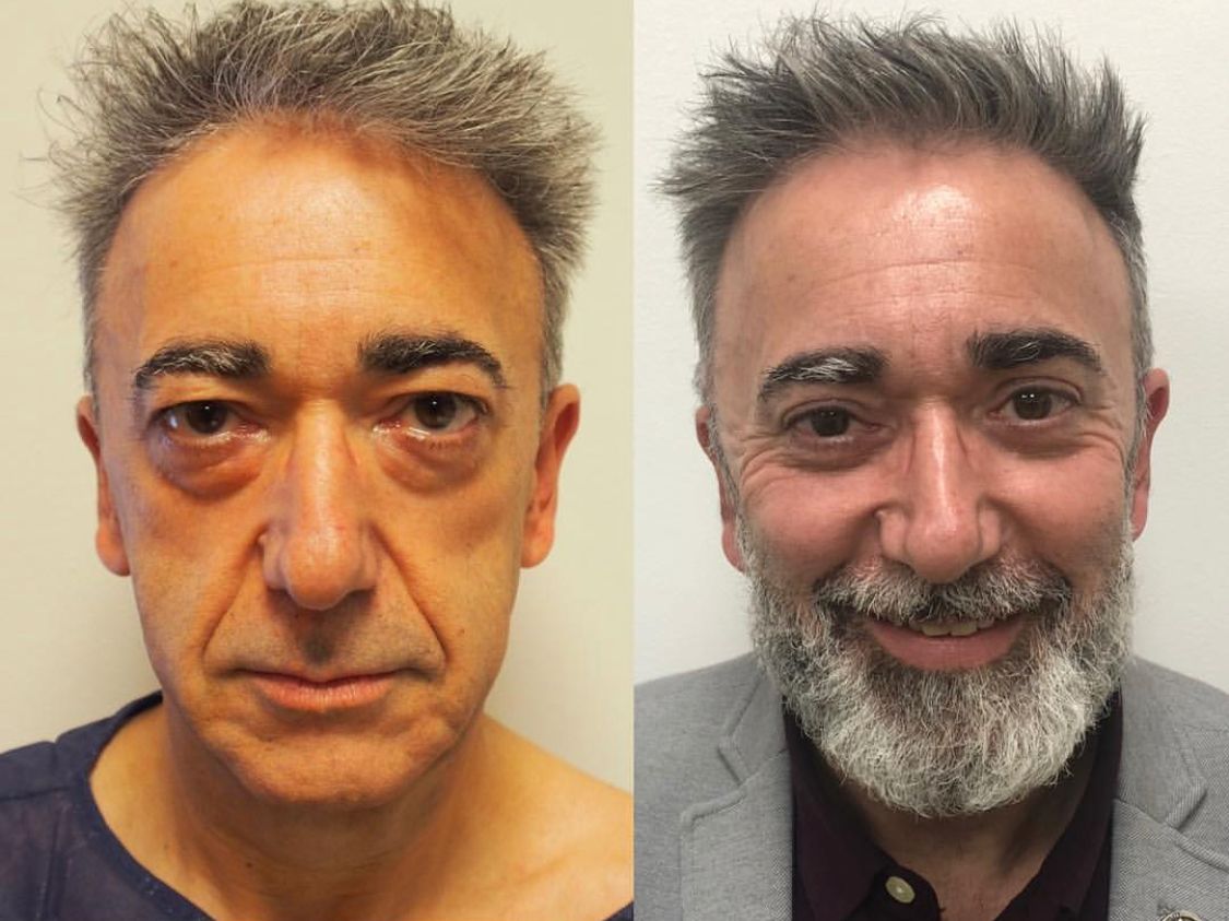 Alberto Candau Álvarez-36