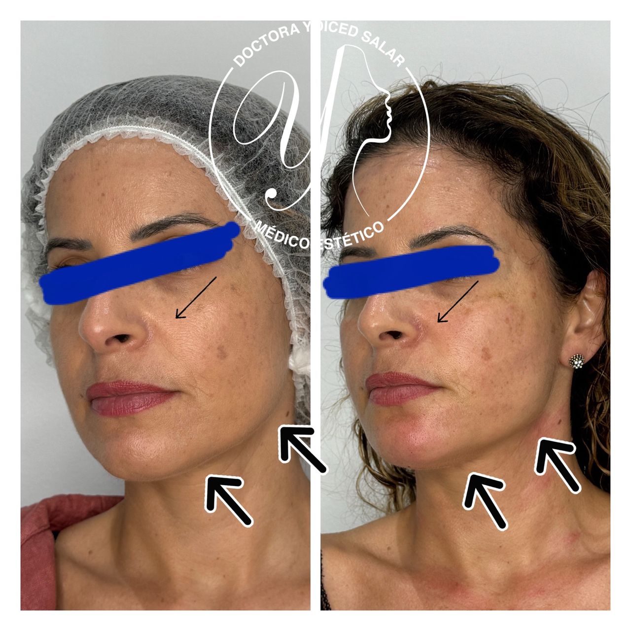 Yoiced Salar Peñate-29