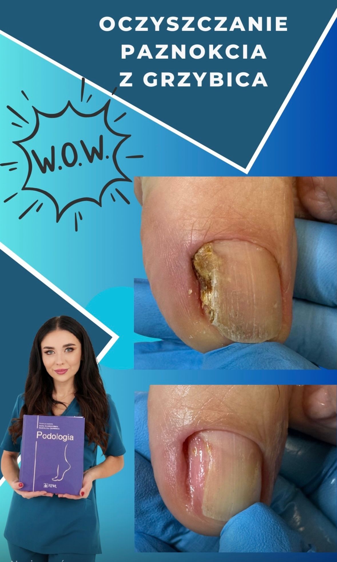 Karolina Colonna-Walewska-19