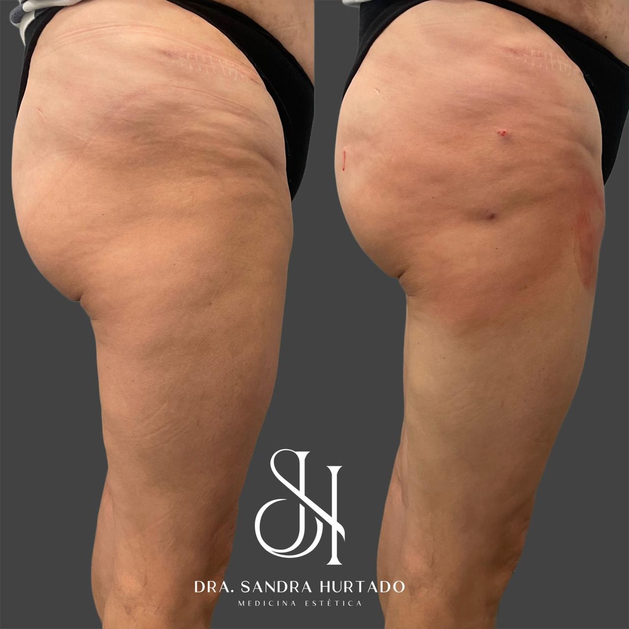 Sandra Hurtado Farreras-1