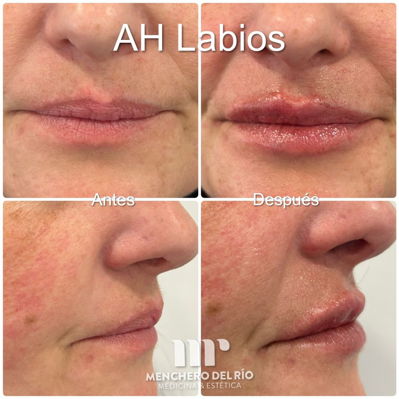 Arsenio Menchero Sánchez-37