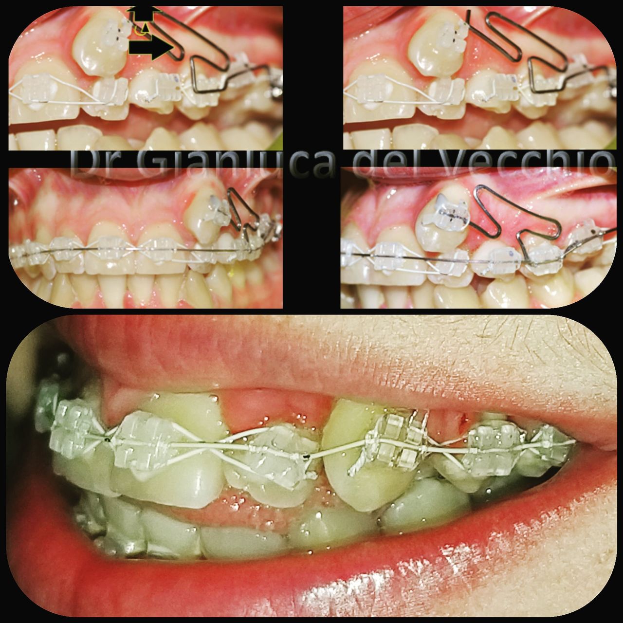 Gianluca Del Vecchio-26