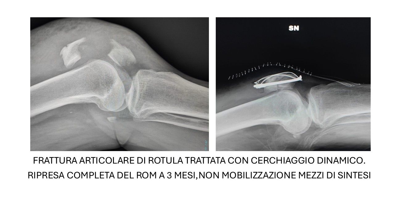 Bartolomeo D'amora-2