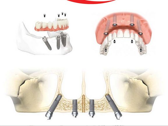 Alessandro Palumbo-44