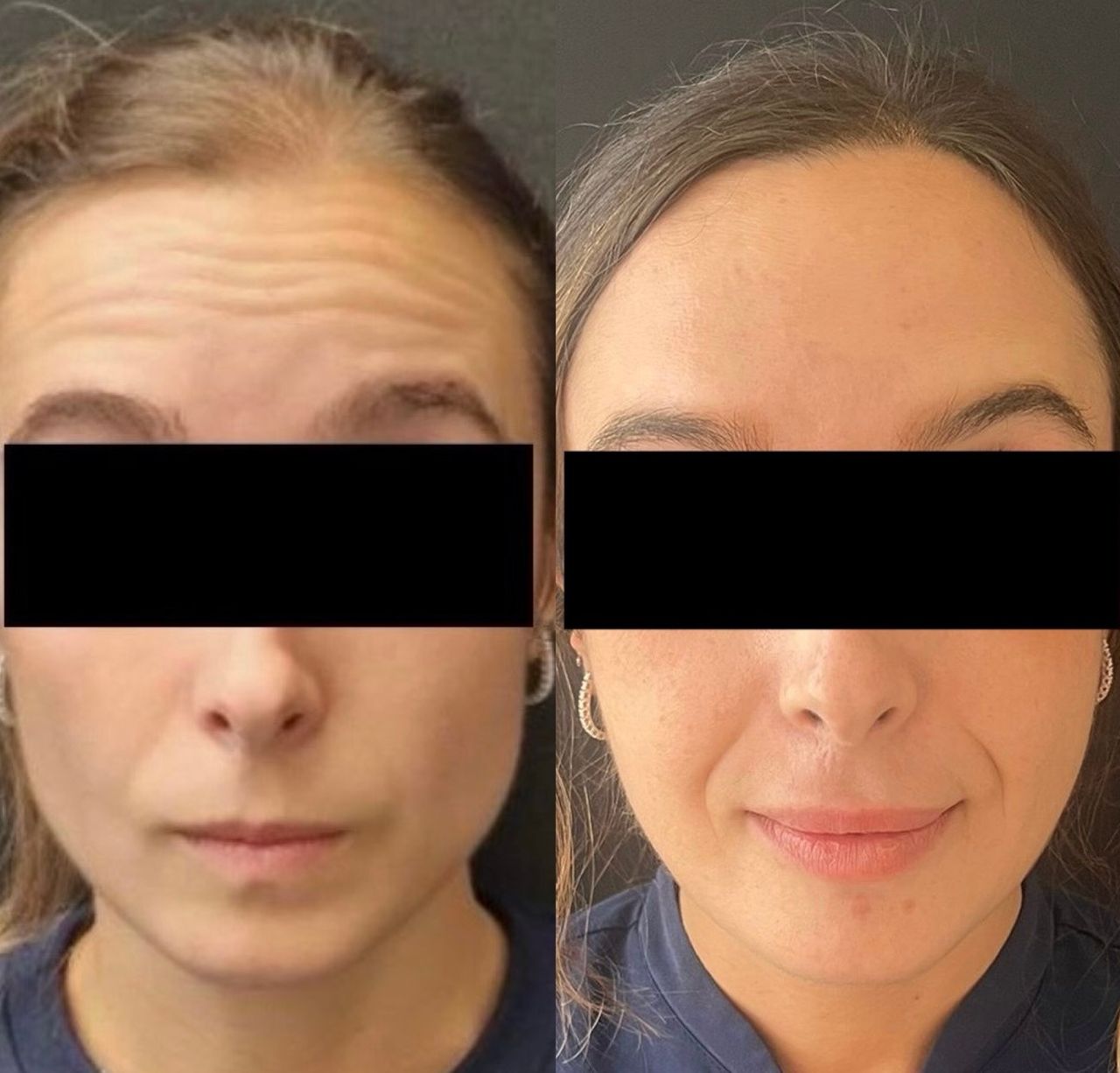 Medicina Estetica Bernini-1