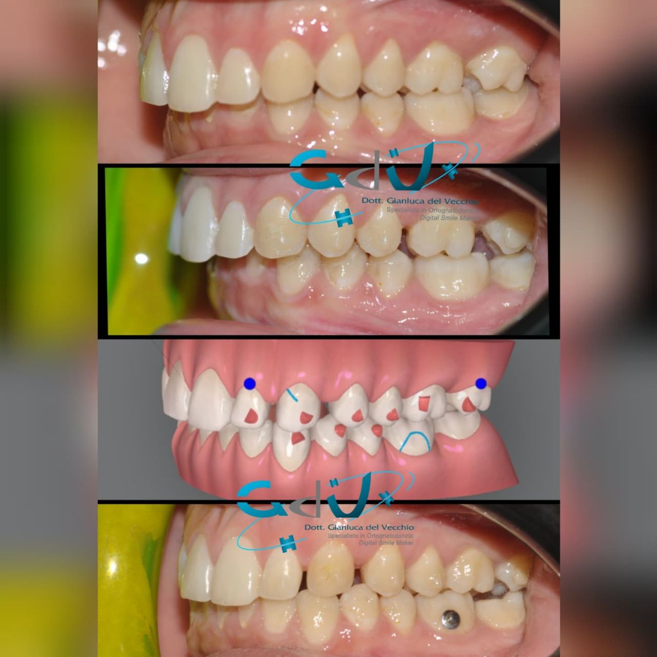 Gianluca Del Vecchio-127