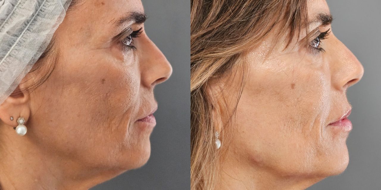 Rosalba Herrero Zerpa-38