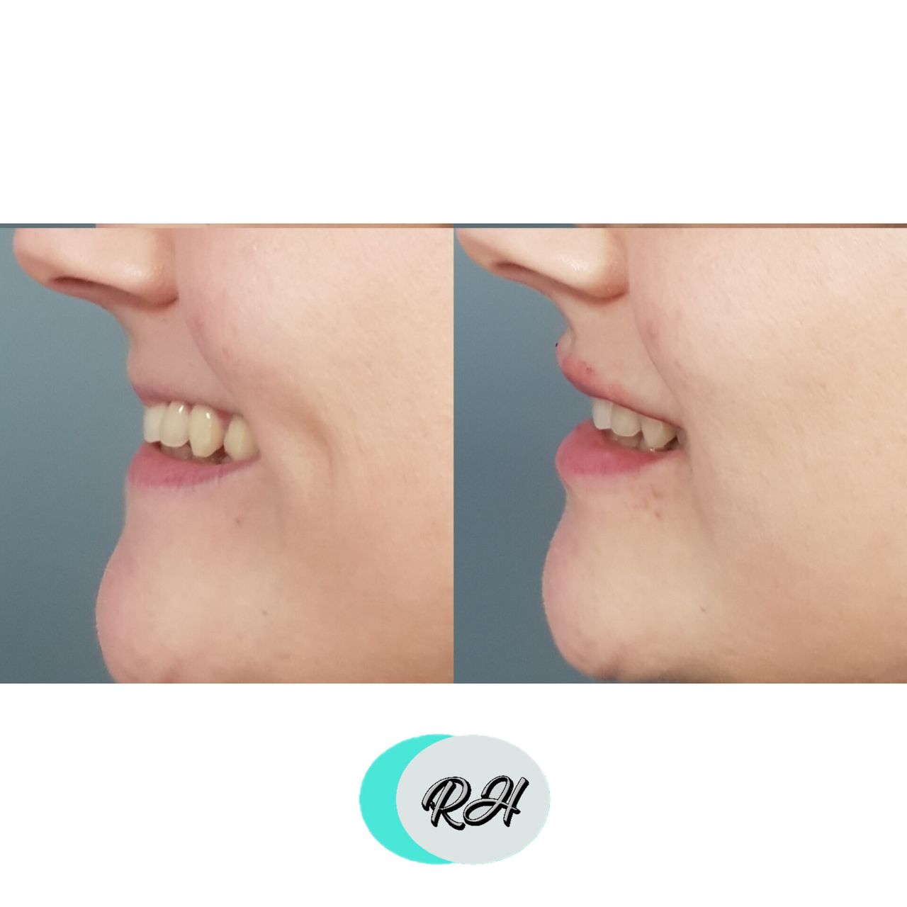 Rosalba Herrero Zerpa-91