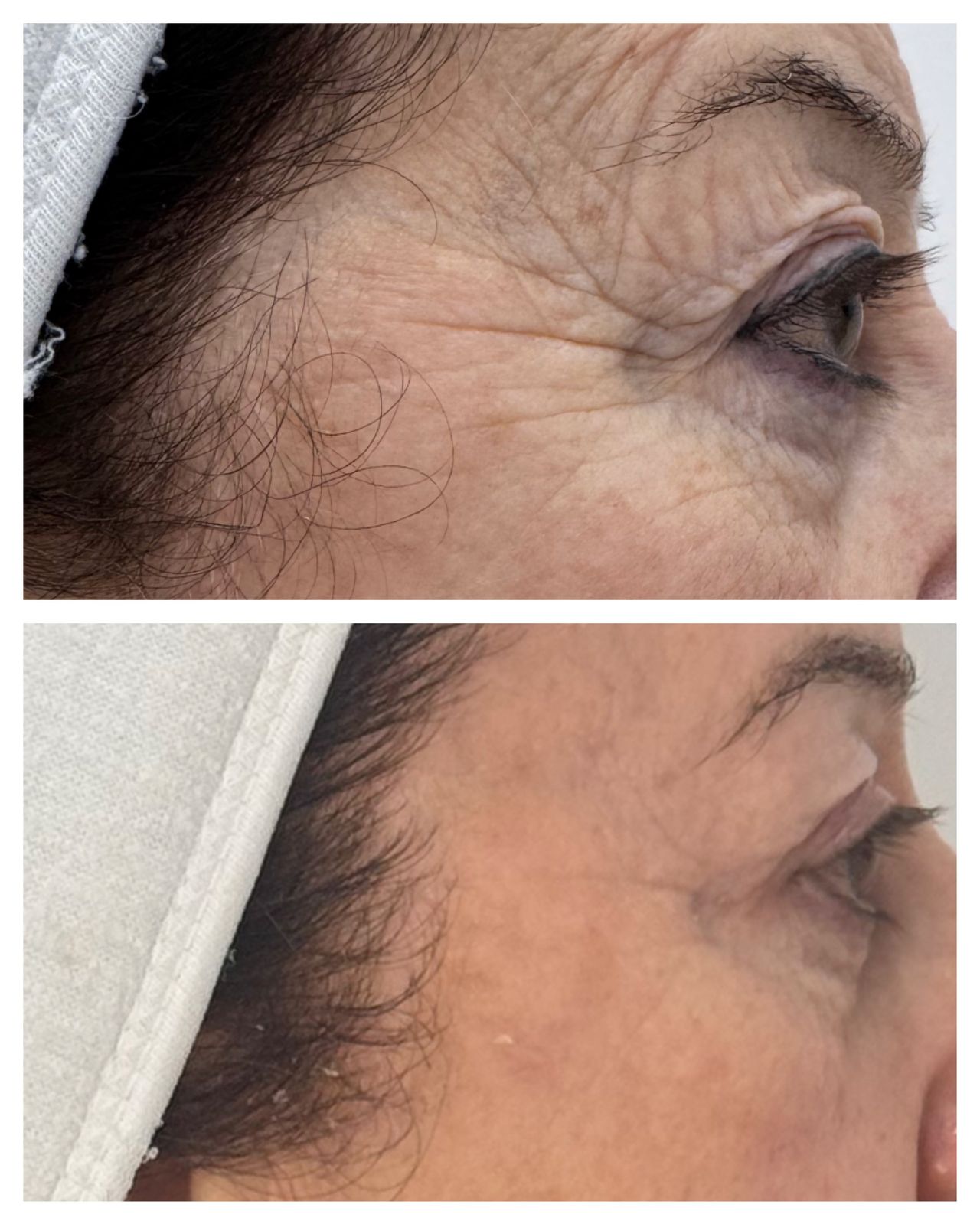 Yolimar Acevedo Raya-0