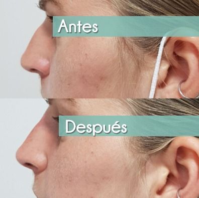 Rosalba Herrero Zerpa-316