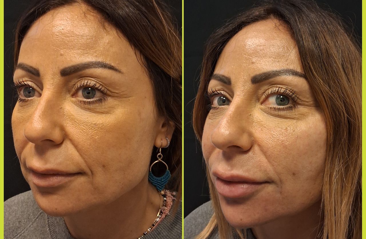 Federica Ingallina-50