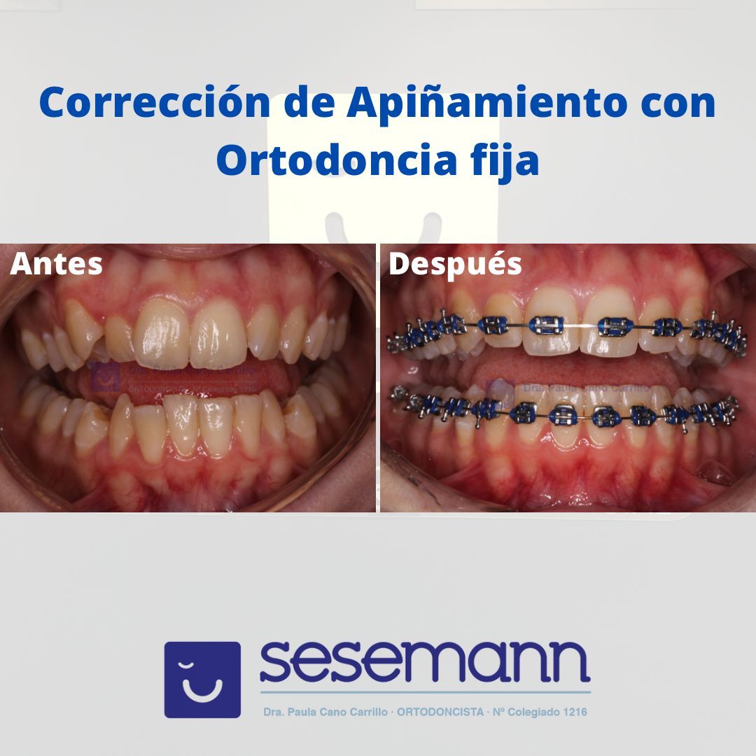 Paula Cano Carrillo-29