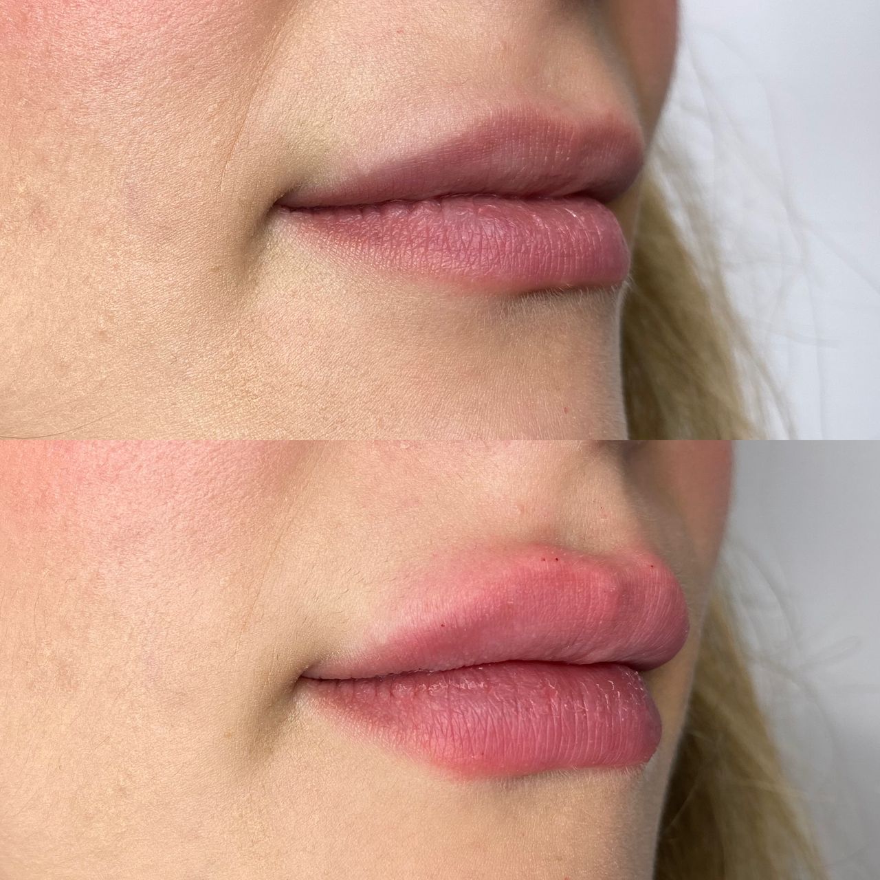 Antonio Napoletano-6