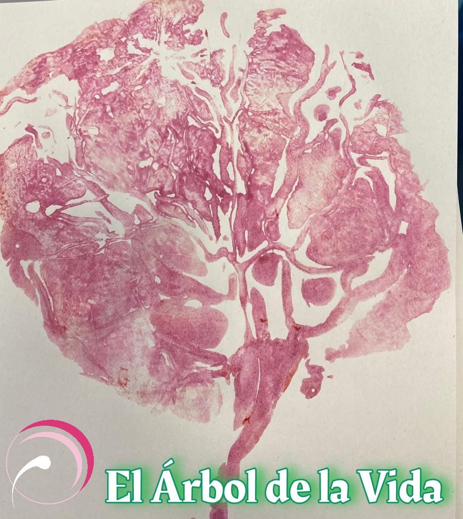 Mª Angeles Escudero Turpín-3